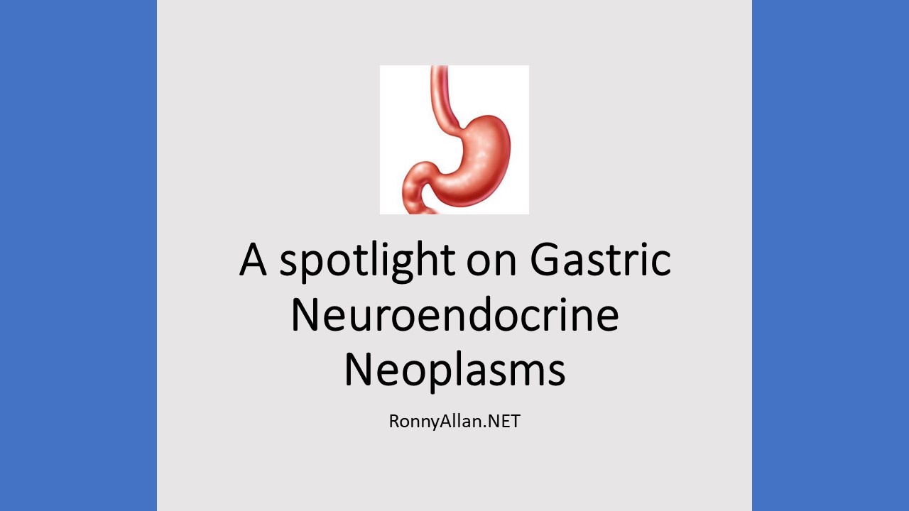 A spotlight on Gastric Neuroendocrine Neoplasms (based on 2026 WHO Classification)